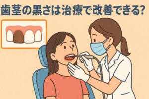 松たか子 歯と歯茎の黒さは改善できる?
