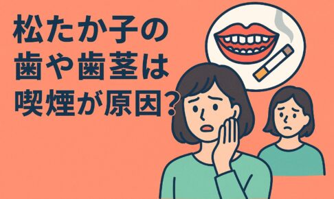 松たか子の歯と歯茎は喫煙が原因