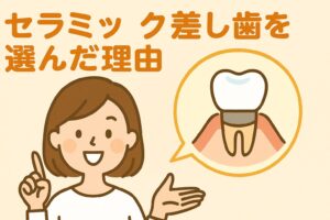 松たか子 セラミック差し歯を選んだ理由